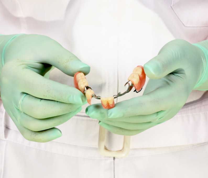 What Are Dental Crowns and Bridges?