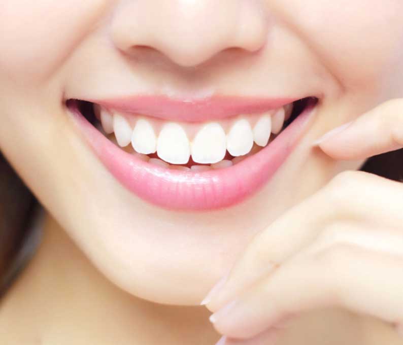 Lip Repositioning Surgery