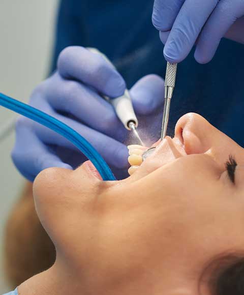 The Domino Effect: Understanding the Effects of Delaying Your Dental Treatment